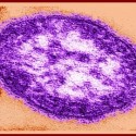 No Measles Cases in Livingston County