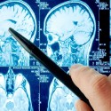 House Passes Bill for Concussion Policies in Schools